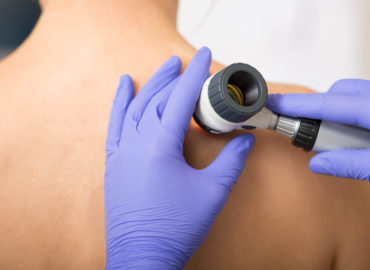 Doctor examining patient skin moles with dermoscope